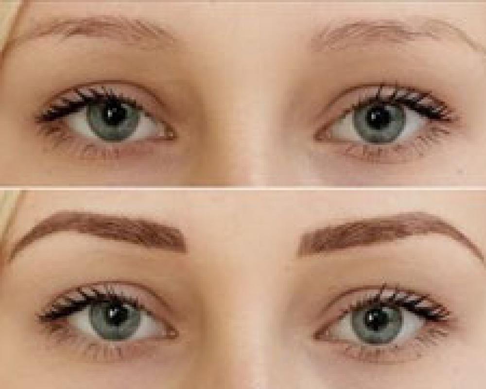 Microblading